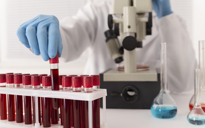 Доктор Мясников предупредил об опасности самостоятельной сдачи анализа на D-димер