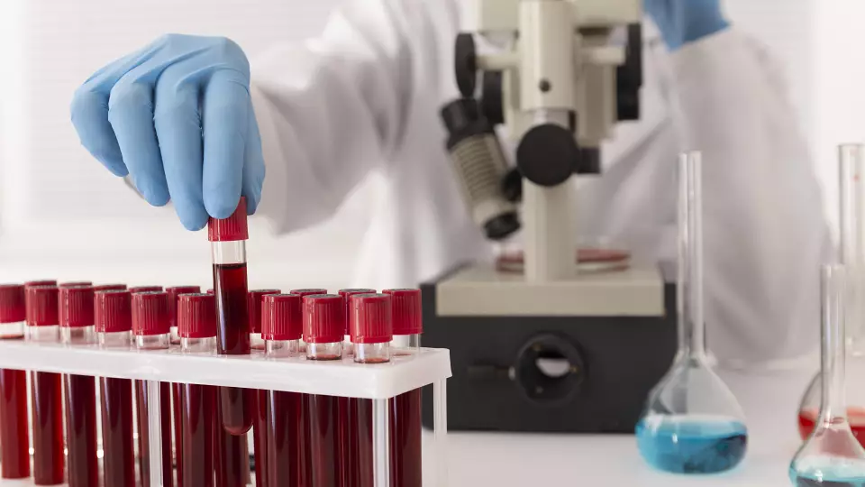 Доктор Мясников предупредил об опасности самостоятельной сдачи анализа на D-димер