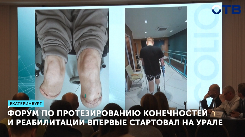 Форум по протезированию конечностей и реабилитации впервые стартовал на Урале