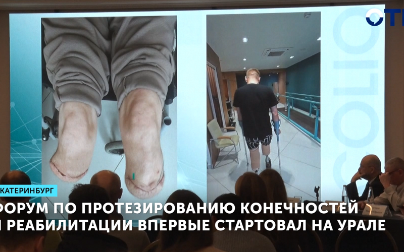 Форум по протезированию конечностей и реабилитации впервые стартовал на Урале