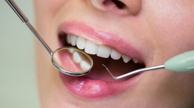 Популярные отбеливающие пасты оставляют микроповреждения на эмали