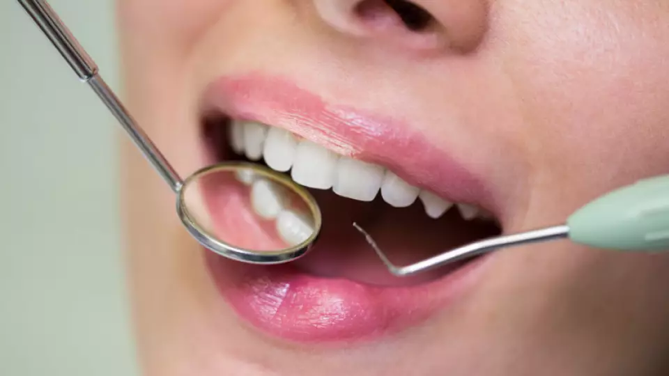 Популярные отбеливающие пасты оставляют микроповреждения на эмали