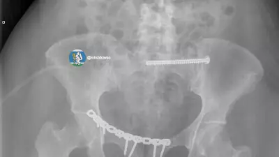 Врачи в Екатеринбурге спасли женщину, которую переехал автомобиль