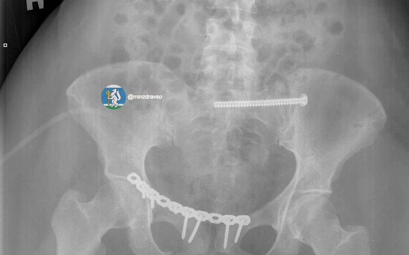 Врачи в Екатеринбурге спасли женщину, которую переехал автомобиль