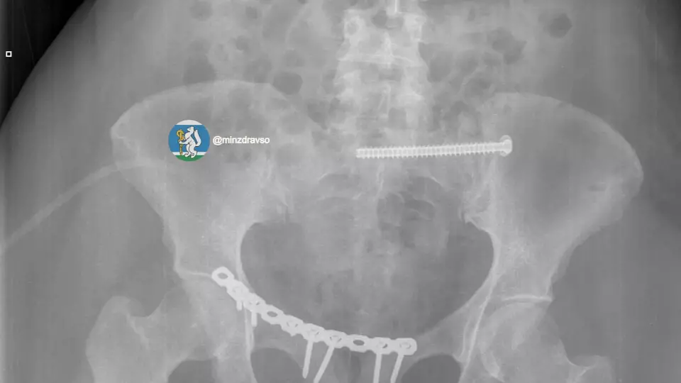 Врачи в Екатеринбурге спасли женщину, которую переехал автомобиль