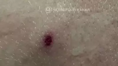 "У ребёнка четыре раны": детей обстреляли из травмата в Екатеринбурге