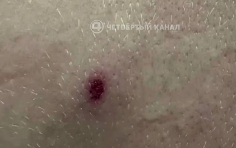 "У ребёнка четыре раны": детей обстреляли из травмата в Екатеринбурге