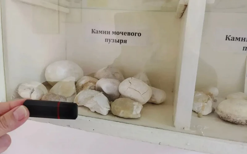 Свердловские врачи удаляют камни в почках за 30 минут без разрезов с помощью нового российского лазера