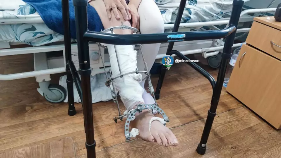 В Алапаевске врачи пришили женщине почти оторванную мотоблоком ступню