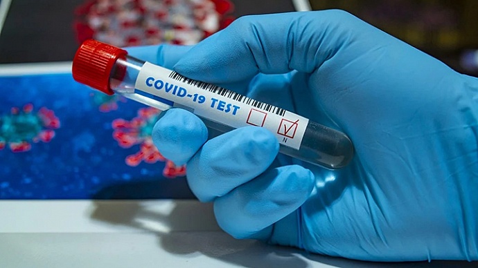 На Среднем Урале 521 новый случай COVID-19: статистика по коронавирусу