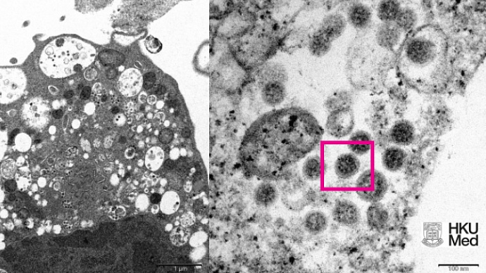 Учёные опубликовали первое изображение омикрон-штамма коронавируса